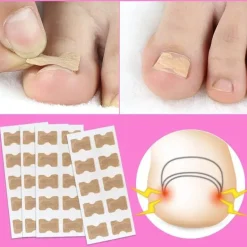 Aufkleber zur Korrektur eingewachsener Zehennägel – Behandlung der Zehenausrichtung