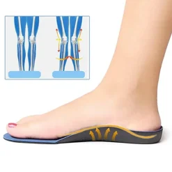 Einlegesohlen zur Unterstützung des Plattfußgewölbes – bequeme Korrekturpolster