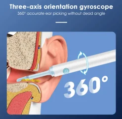 Kabelloser Ohrenreiniger – Sanftes Werkzeug zur Ohrenschmalzentfernung