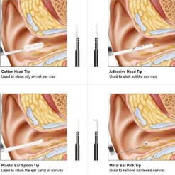 Mini-Ohrreinigungskamera – visuelles Werkzeug zur Ohrenschmalzentfernung