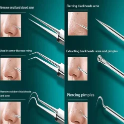 Mitesserentferner-Set – Lösung für reine Haut und Akne