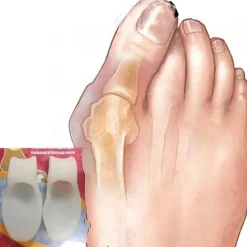 Orthopädischer Zehentrenner – Fußkorrektor aus Silikongel