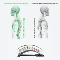 Rückenschmerzlinderungs-Stretcher - Magisches Wirbelsäulenmassagegerät für Leichtigkeit und Komfort