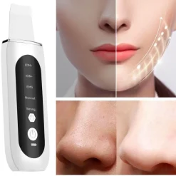 Ultraschall-Gesichtsreiniger – Tiefenreinigendes Anti-Akne-Gerät