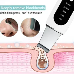 Ultraschall-Gesichtsreiniger – Tiefenreinigendes Anti-Akne-Gerät